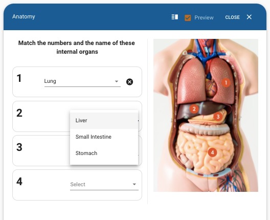 A matching question with an image about human anatomy in Testinvite Test Software